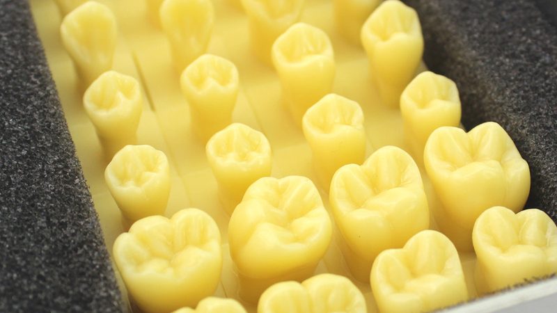 儿童隐形牙套矫正器：如何选择适合自己的产品？**