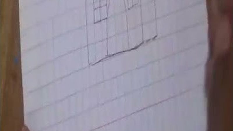 隐形牙套矫正后的后遗症，治疗费用如何考量？**