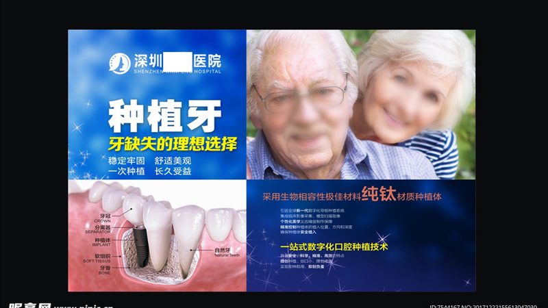 牙齿美白贴面：揭秘其优势与选择要点**